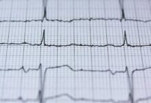 global pulse conversion horizon